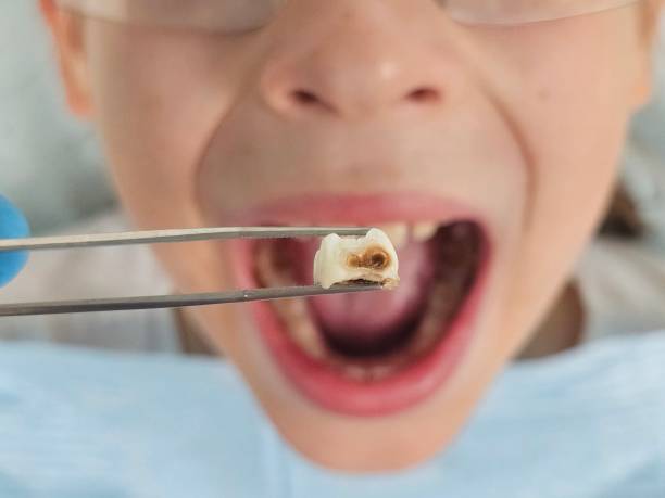 Best Same-Day Emergency Dentist in Spencerville, MD